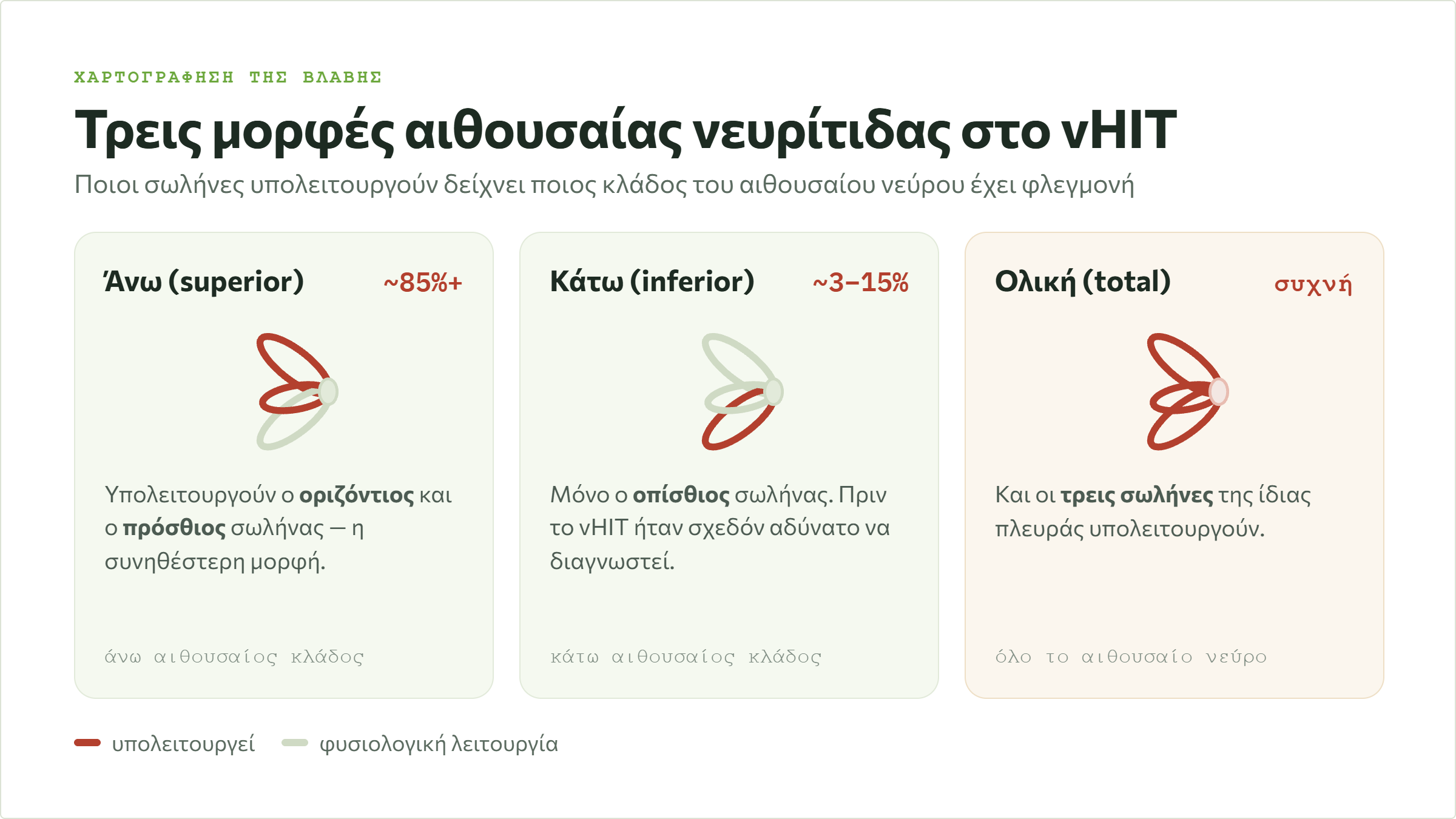 Οι τρεις μορφές αιθουσαίας νευρίτιδας στο vHIT: άνω με οριζόντιο και πρόσθιο σωλήνα, κάτω με οπίσθιο σωλήνα και ολική με τους τρεις σωλήνες